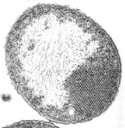 E. coli infected with phage f2