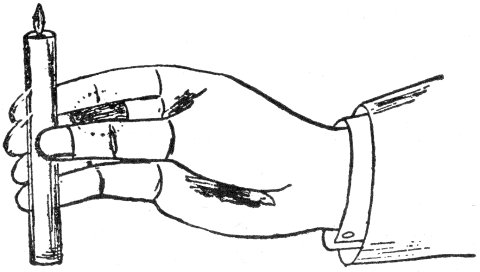 Fig. 6.  Application of the Finger Palm.