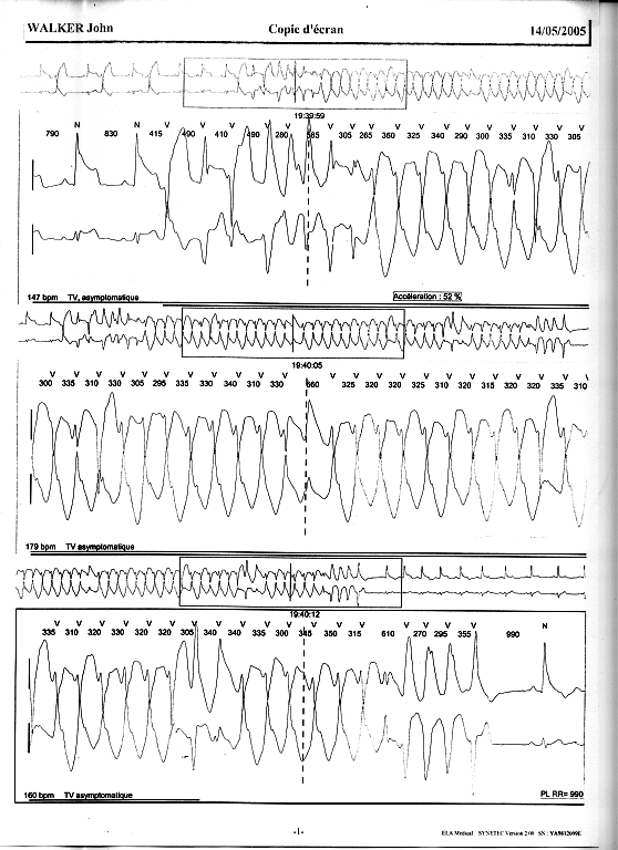 http://www.fourmilab.ch/fourmilog/archives/ecg2_a.png