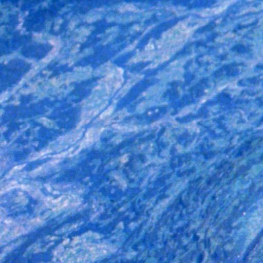 Zoomed image: 4,5
