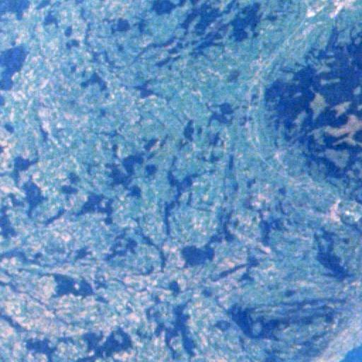 Zoomed image: 7,11